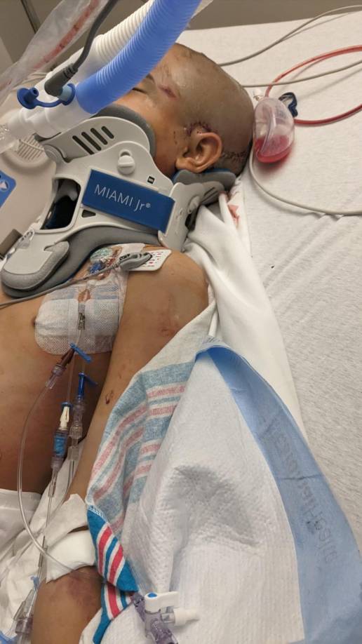 “El niño está bastante grave, la verdad. Es lamentable por lo que él está pasando”, dijo su padre, Javier Flores.