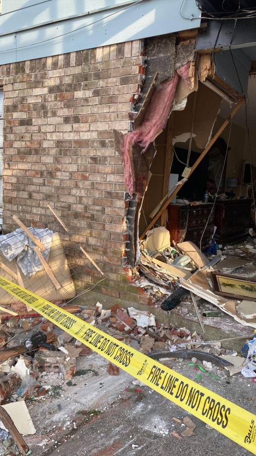 Adrián ya fue intervenido quirúrgicamente dos veces ya que tiene fracturas en todas las piernas hasta la cintura.