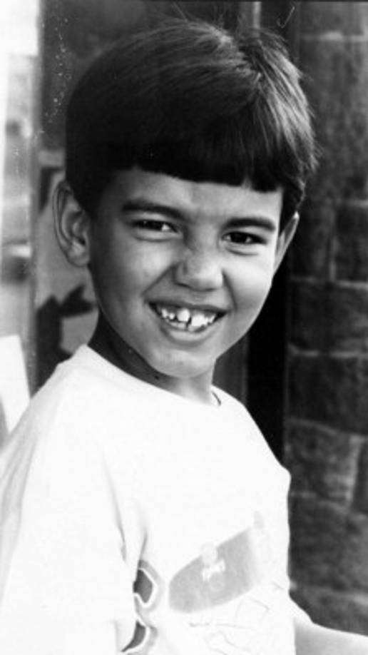 Alves nació en Brasil, y según le contó a la revista People, cuando iba en la escuela se burlaban de su nariz y de su figura. De ahí nació su idea de someterse al bisturí para cambiar su aspecto.