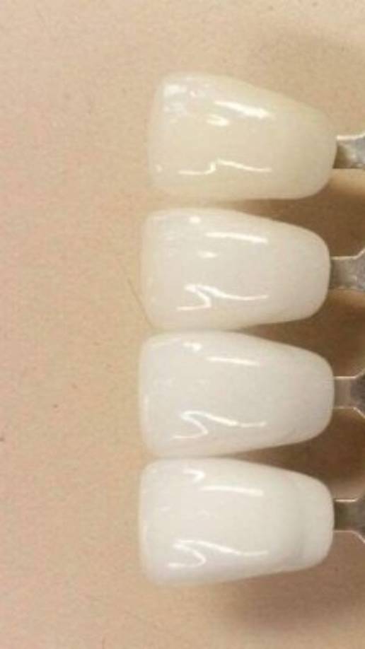 Para celebrar su cumpleaños número 34, el presentador de televisión viajó a Irán para hacerse su décima cirugía en la nariz, pero durante la operación, los médicos quebraron accidentalmente sus dientes delanteros, así que también le tocó estrenar sonrisa. <br/>