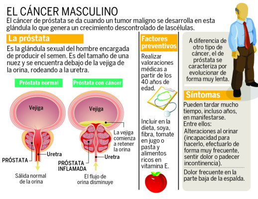 Aumentan casos de cáncer prostático