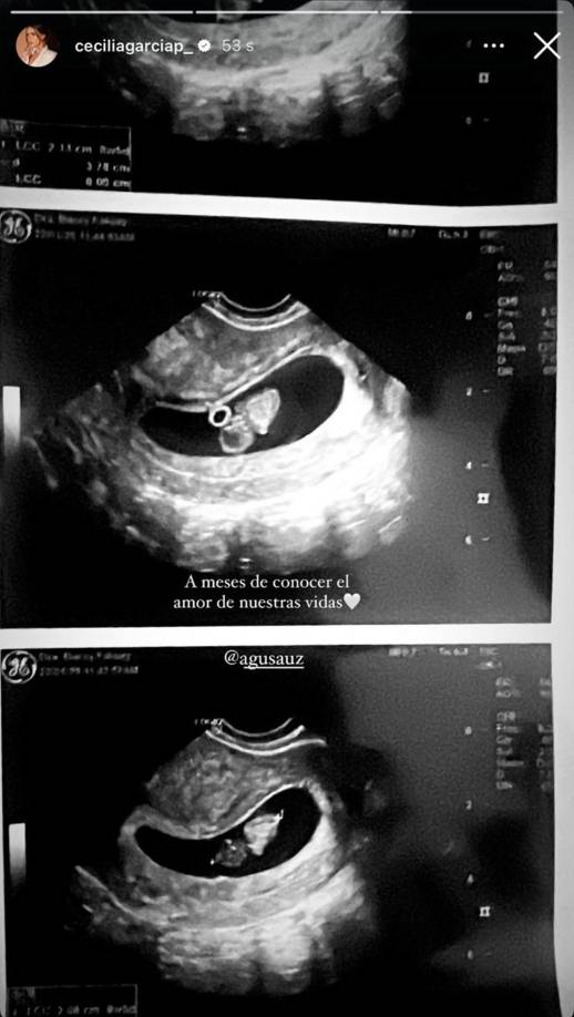 Cecilia García compartió en su cuenta de Instagram imágenes del ultrasonido mostrando su embarazo. “A meses de conocer el amor de nuestras vidas”, escribió.
