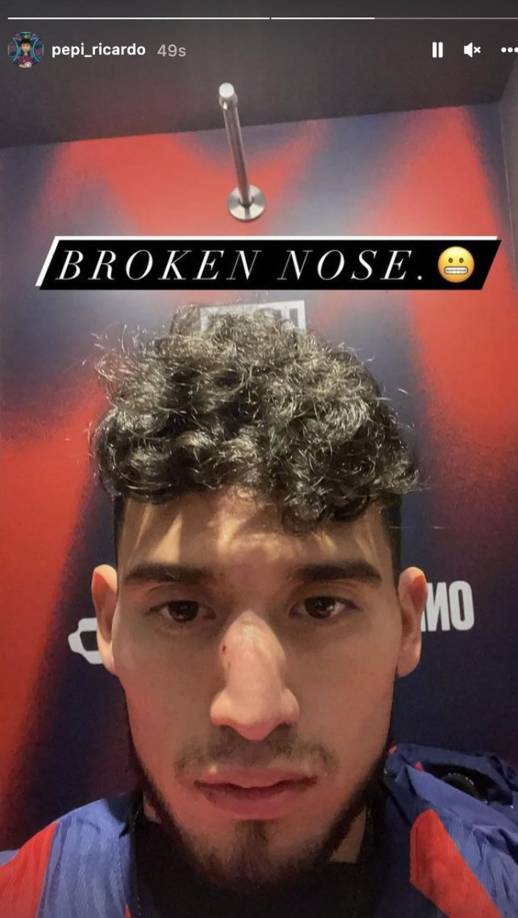 El delantero estadounidense Ricardo Pepi terminó el partido con la nariz rota tras un golpe que se llevó en una acción con Denil Maldonado.