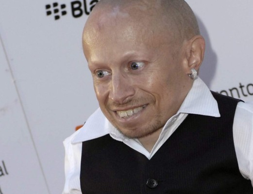 Muere Verne Troyer, el actor que interpretó a 'Mini-Me' en Austin Powers