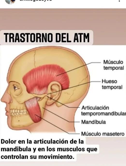 Detienen a falso quiropráctico en San Pedro Sula; lo acusan de abusar de pacientes