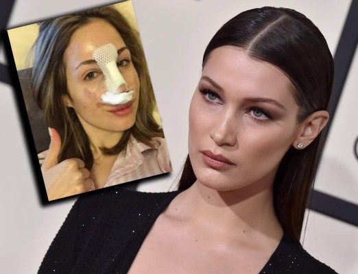 Gasta 25 millones de dólares para parecerse a Bella Hadid