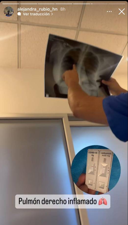 La también influencer compartió los resultados de sus estudios y resultó con el pulmón derecho inflamado. 