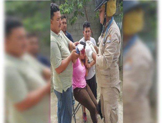 Mujer casi pierde la mano en una máquina para hacer tortillas