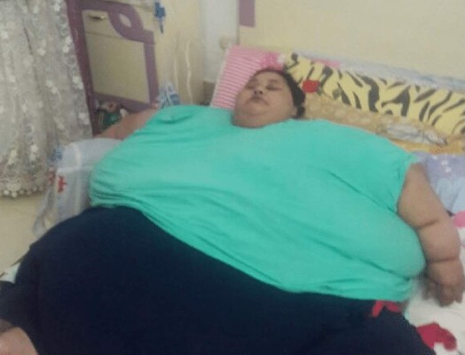 La mujer egipcia operada perdió 300 kilos en tres meses