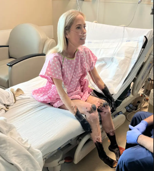 Las extremidades de Sherri comenzaron a necrosarse hasta volverse negras y momificadas, dijo David, esposo de la mujer. “Vi morir literalmente los pies y las manos de mi mujer”. 