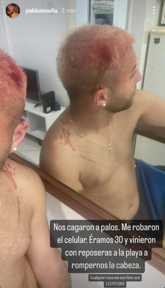 “Nos cagaron a palos. Me robaron el celular. Éramos 30 y vinieron con reposeras a la playa a rompernos la cabeza”, contó uno de los hinchas, Pablo Moulia, quien subió una historia de Instagram con una foto del golpe que recibió en la cabeza.