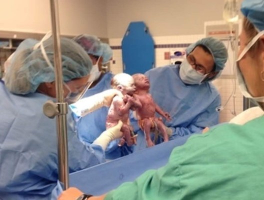 El mejor regalo de las madres: nacen sus gemelas tomadas de la mano