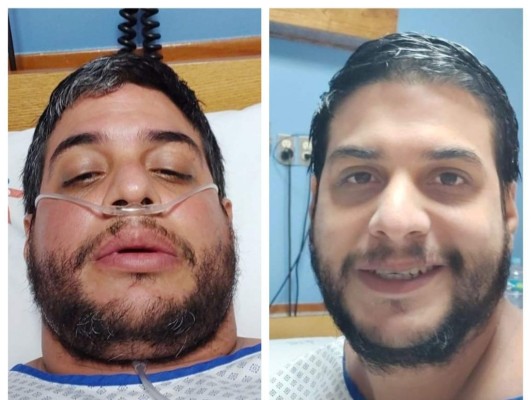 'No podía respirar, la vida se me iba, pero Dios no me abandonó”: Farid Martínez