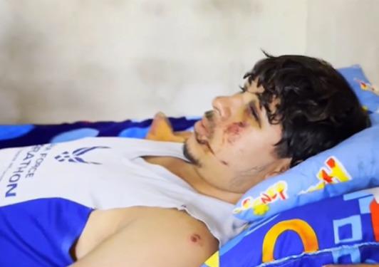 Capturan a motorista de rapidito que cayó a hondonada y que dejó dos muertos en la Lempira