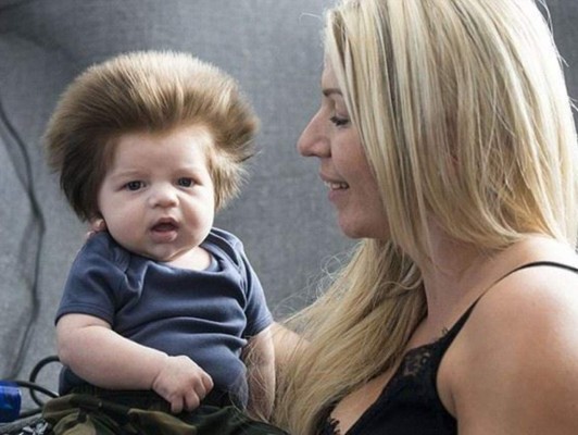 Mirá por qué este bebé enamora las redes sociales