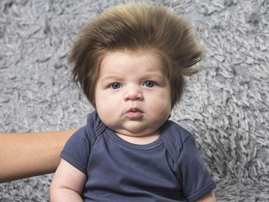 Mirá por qué este bebé enamora las redes sociales