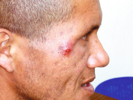 Honduras: indiferencia del Estado en el valle de Siria