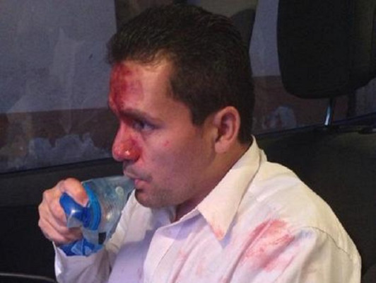 Honduras: Golpean a candidato a alcalde de Tegucigalpa por el PAC