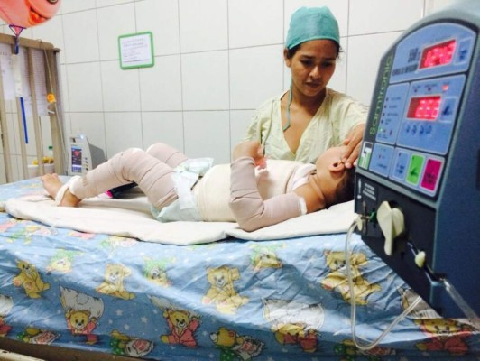 Niña hondureña con quemaduras necesita ser tratada en EUA