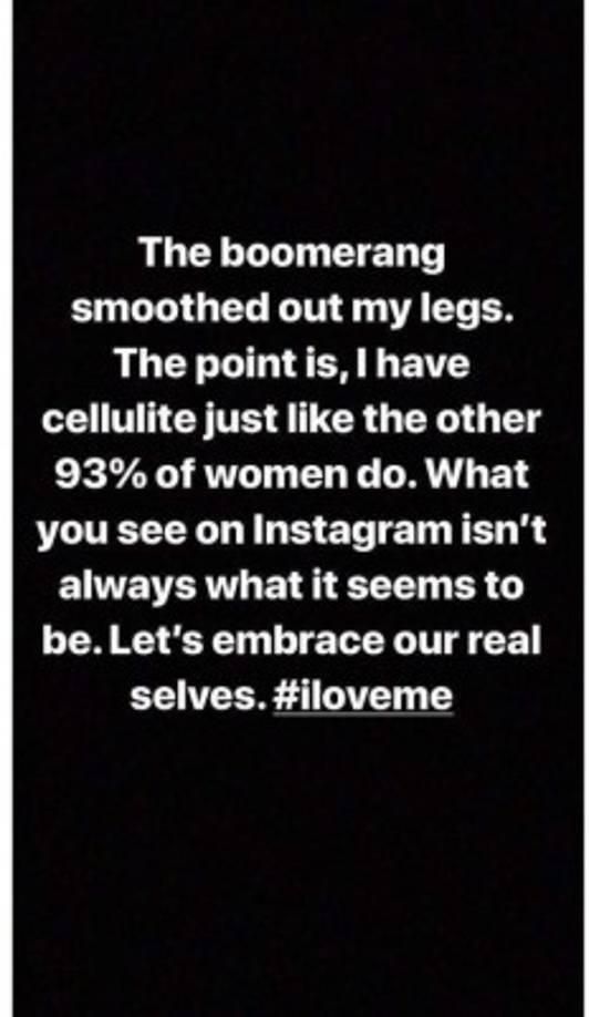 La artista escribió '... Tengo celulitis como el otro 93% de las mujeres. Lo que ves en Instagram no siempre es lo que parece. Aceptémonos como somos. #YoMeAmo' expreso en una publicación en su Instagram Stories.