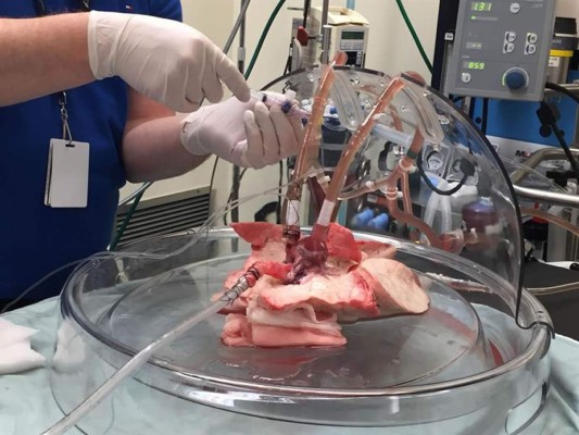 Brasileños desarrollan una técnica para descontaminar órganos trasplantados