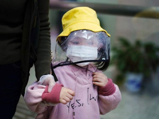 Genes podrían aumentar riesgos de covid en personas con síndrome de Down