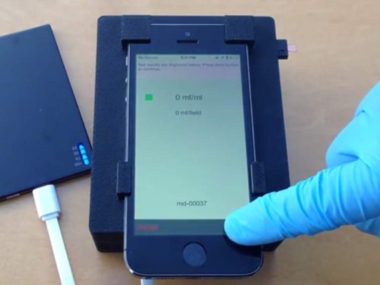 Un microscopio de teléfono móvil puede detectar parásitos en gota de sangre