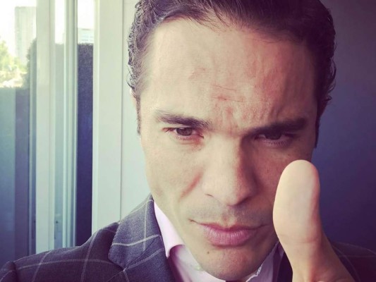 Kuno Becker rompe el silencio tras polémica aparición en TV