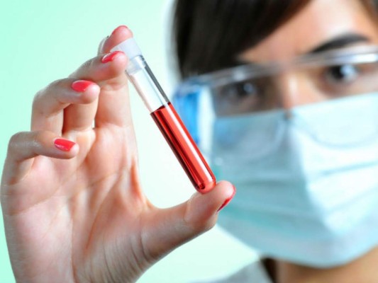 Un análisis de sangre detecta un 86 % de los cánceres de ovarios