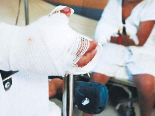 Niño a punto de perder su ojo por quemar pólvora