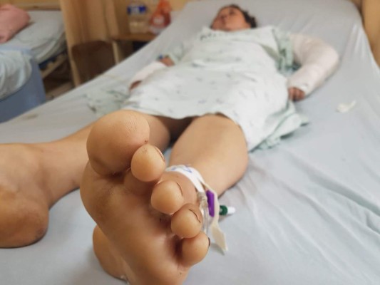 Mujer recibe salvaje golpiza a manos de su pareja