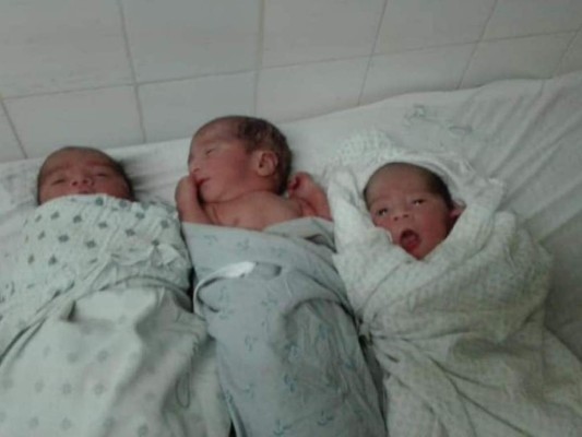 Nacen trillizos en el hospital de Tocoa, Colón