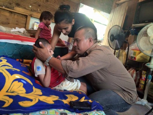 Anthony lucha por su vida tras diagnosticarle microcefalia