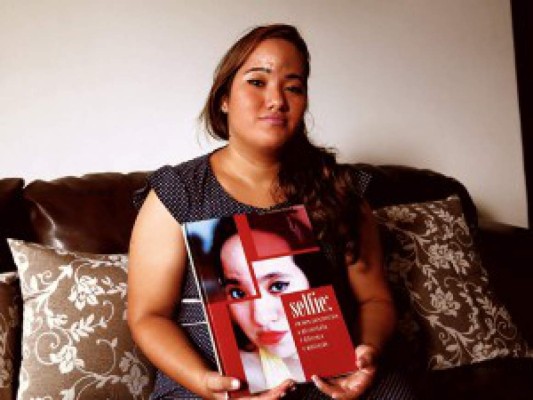 Joven brasileña con microcefalia dice que lleva una vida normal