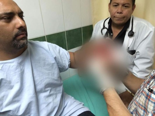 Regidor de Libre: 'No querían amedrentar, ellos querían asesinarme'