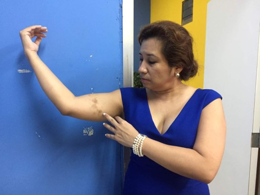 Docente denuncia agresión por parte de directora de Unah-vs