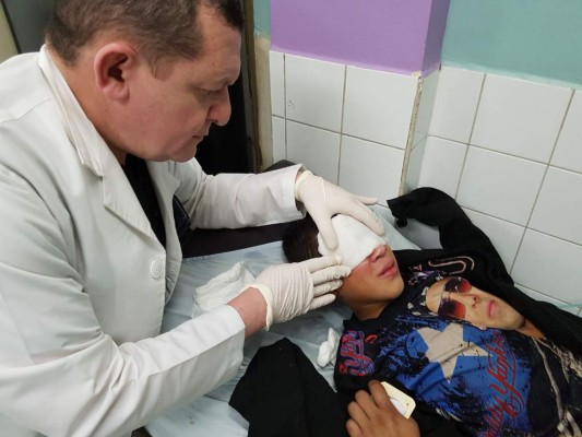 Reportan 31 quemados por uso de pólvora en la Nochebuena