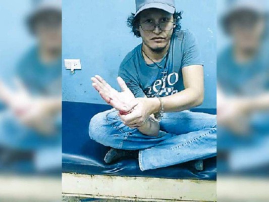 Universitario que atacó a maestro es enviado a hospital psiquiátrico