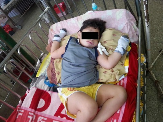 Neumonía ataca a menor que espera operación