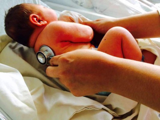 Fallece en Honduras bebé que nació con microcefalia