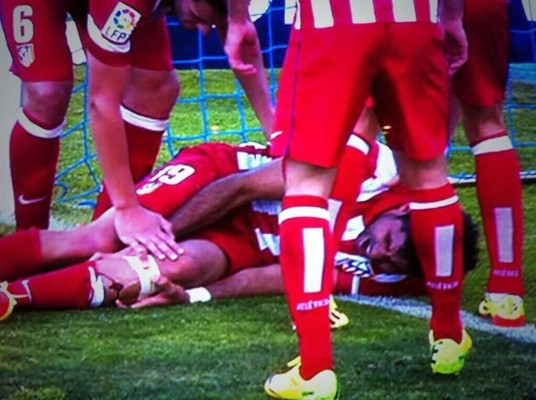 Video: La escalofriante herida de Diego Costa tras golpearse con el poste