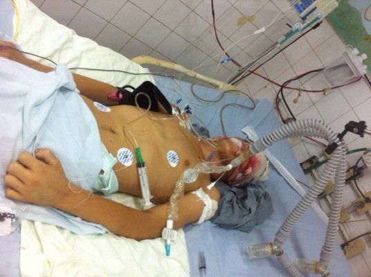 Por balazo, menor sufre muerte cerebral