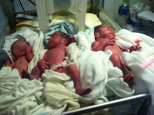 Trillizos siguen hospitalizados y necesitan ayuda de los ciudadanos