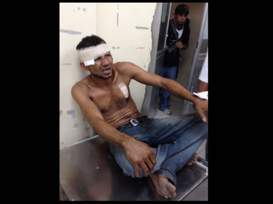 Hombre se escapa de que supuestos mareros lo mataran