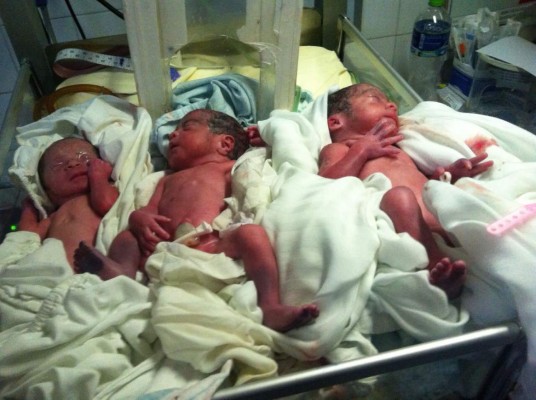 Hondureña da a luz a dos varones y una niña en Santa Bárbara