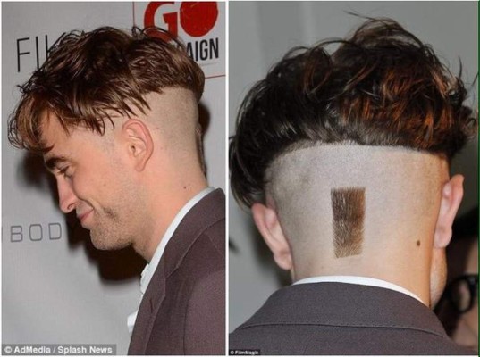 ¿Qué se hizo en la cabeza Robert Pattinson?