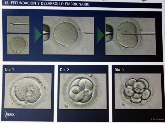 Aumenta el número de casos de infertilidad en Honduras