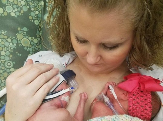 Gemelos nacen con cinco semanas de diferencia en Estados Unidos