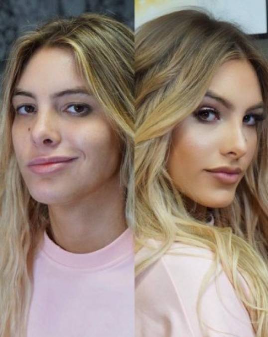 Al aceptar que se ha operado, para Lele Pons mostrarse sin maquillaje ya no le asusta.