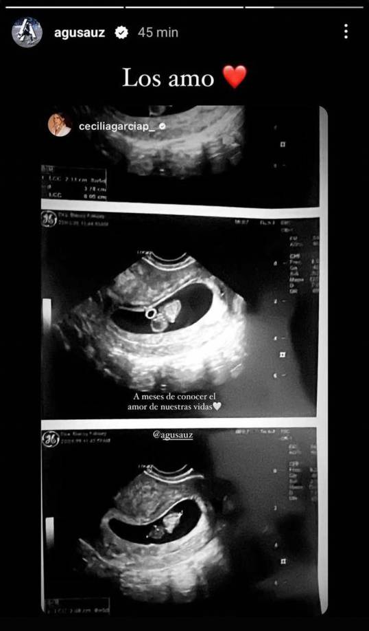 Agustín Auzmendi reposteó la misma imagen de Cecilia García agregando un “los amo”, acompañado de un emoji de corazón.